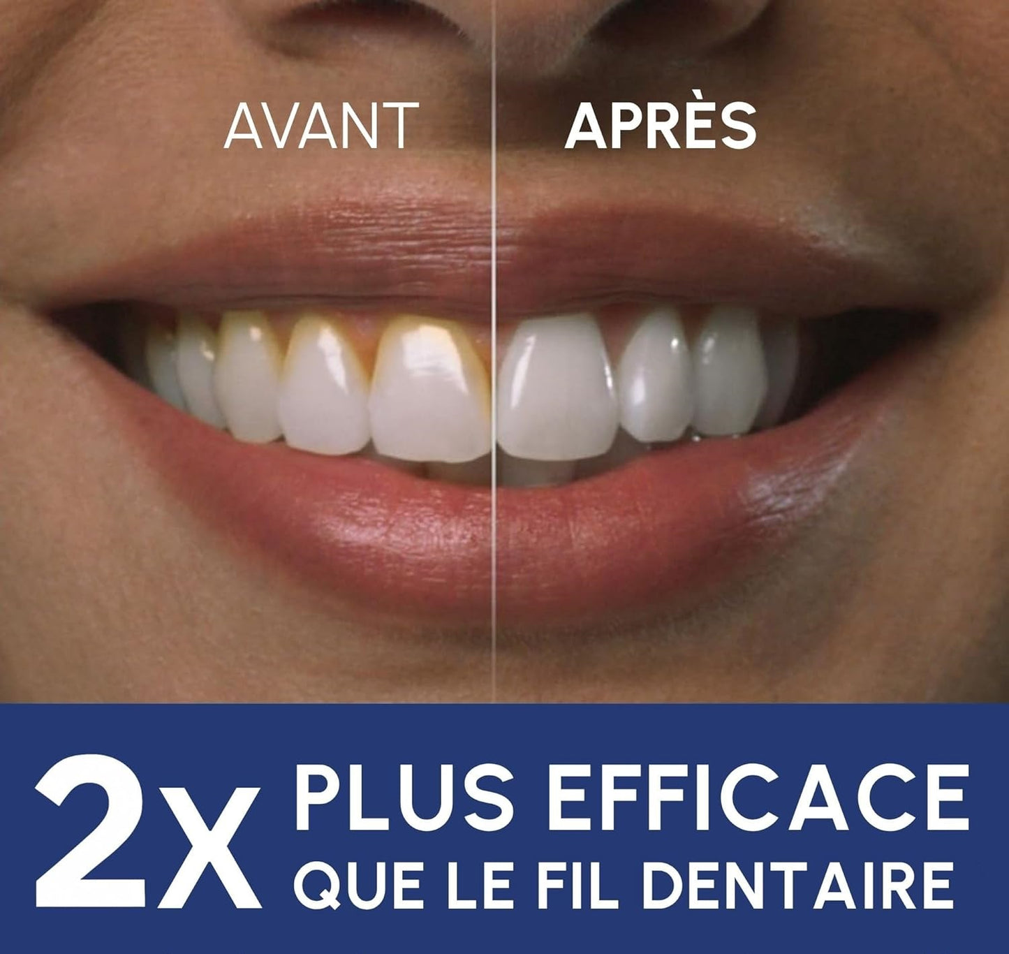 Jet dentaire portable rechargeable par USB avec 4 embouts offerts